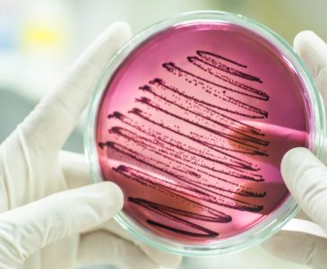 biology-petri-dish biology-petri-dish